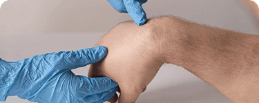 Removal of Lumps, Cysts & Growths