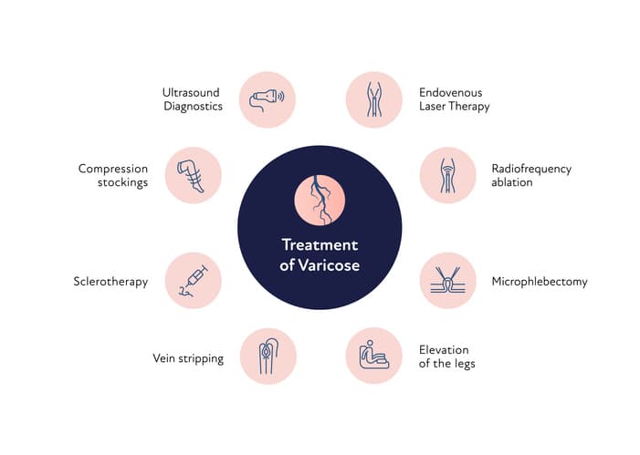 VaricoseVeinsImg1