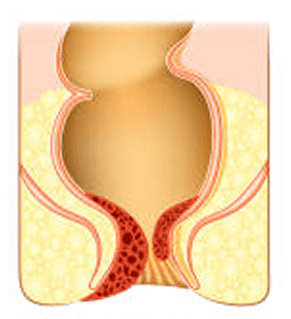 Piles Classification