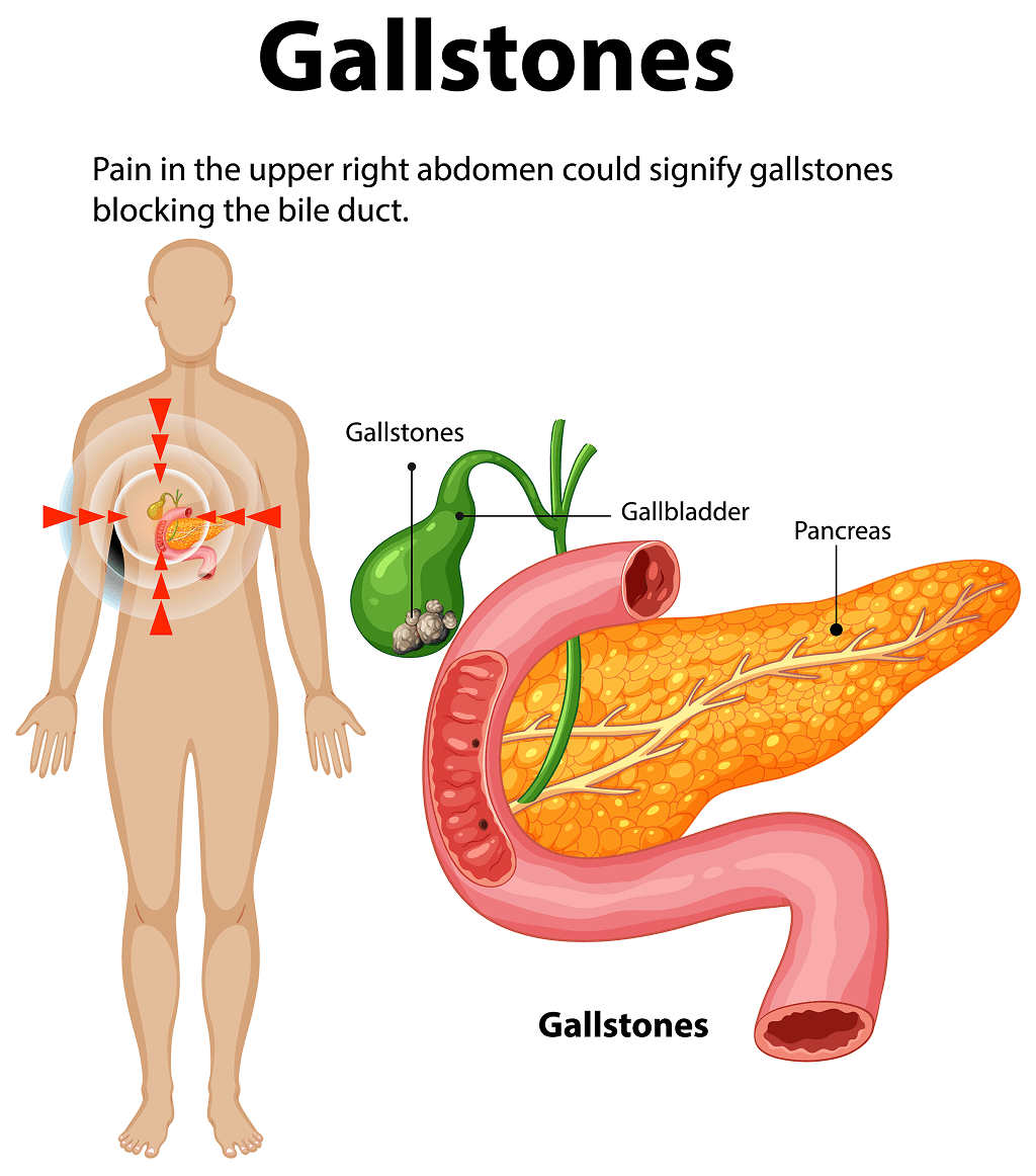 gallbladderImg1