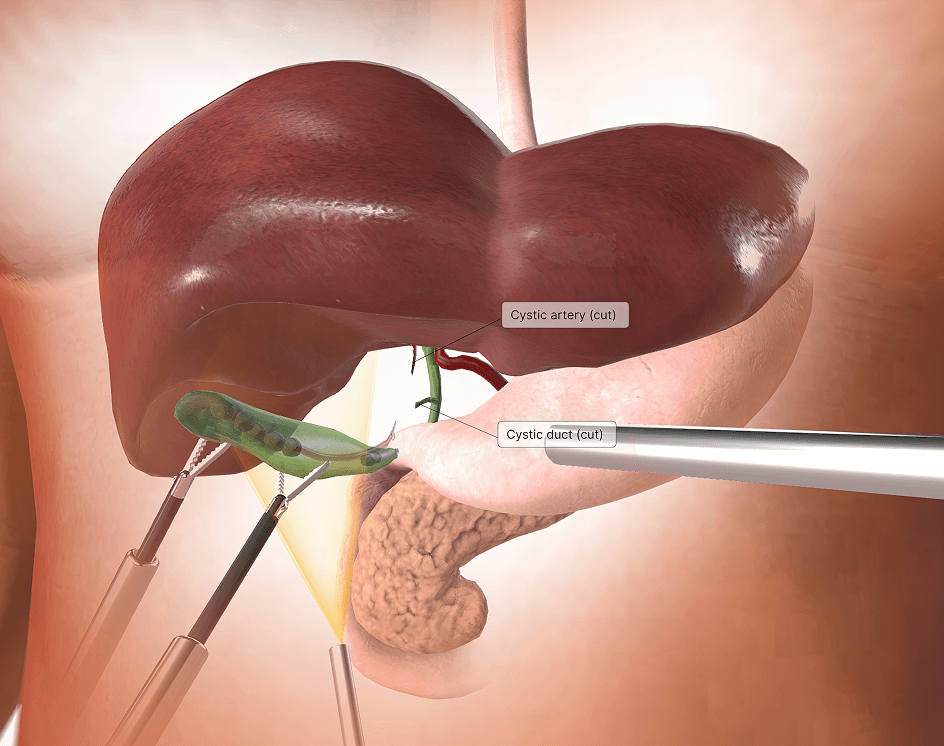 gallbladder