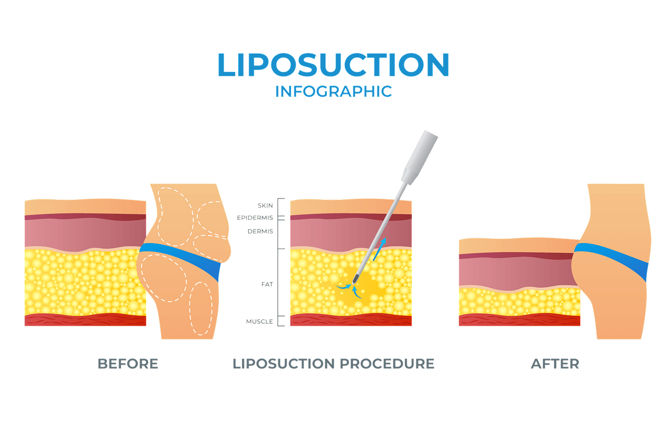reconstructiveSurgeryImg1