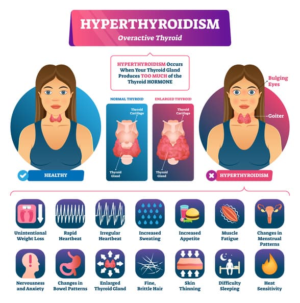 Thyroid