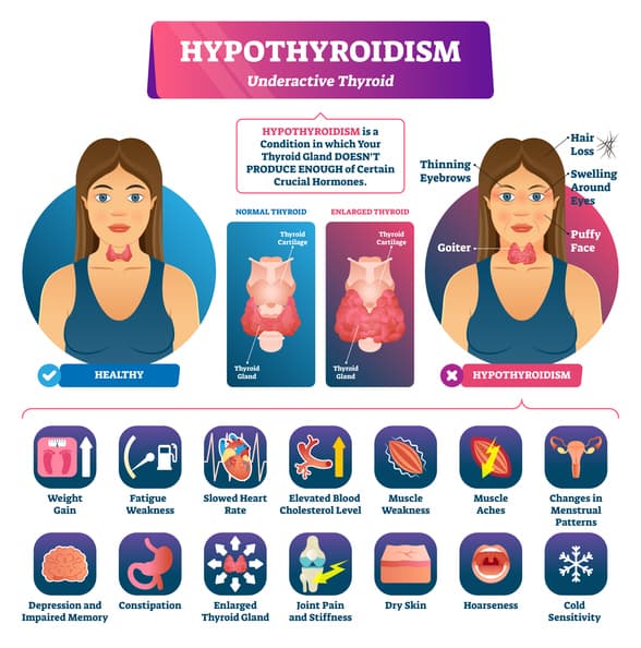 Thyroid